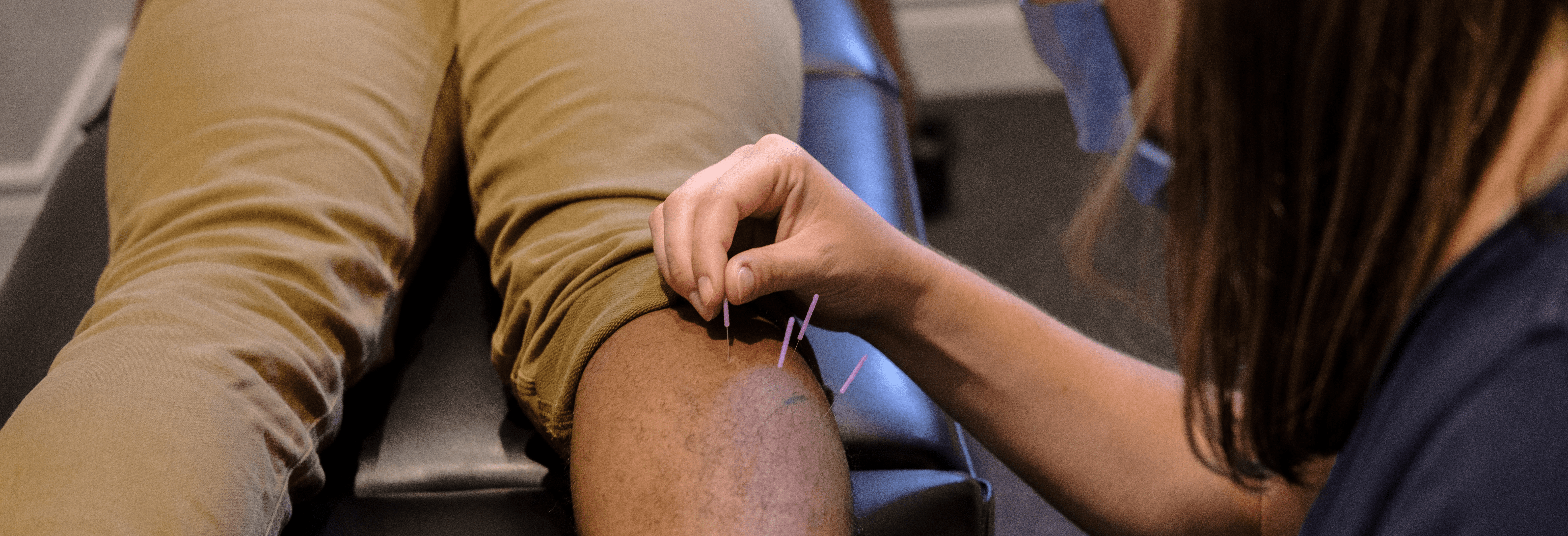 acupuncture